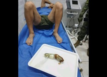 En Quevedo los militares encuentran en el recto de un PPL’s droga, 2 anillos, una cadena de oro, dinero en efectivo y un Chip de telefonía celular
