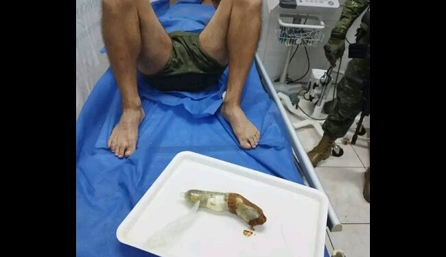 En Quevedo los militares encuentran en el recto de un PPL’s droga, 2 anillos, una cadena de oro, dinero en efectivo y un Chip de telefonía celular